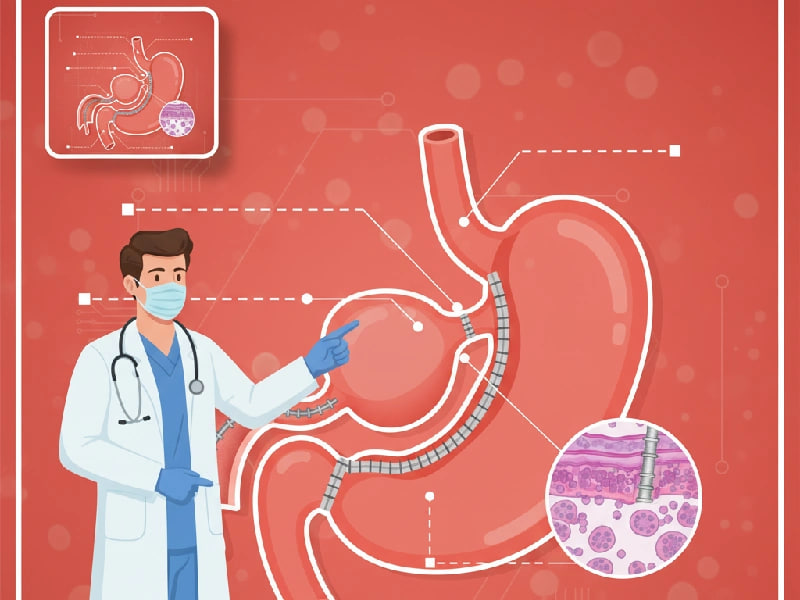 بایپس معده یا اسلیو معده ؟ بررسی تفاوت ها از نگاه بهترین جراح چاقی اسلیوه معده