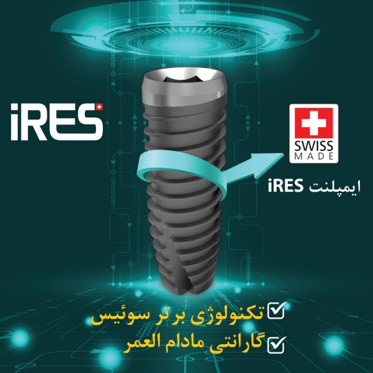 معرفی ایمپلنت آیریس سوئیس (iRES)