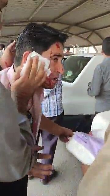 تعداد زیادی از مصدومان امروز بندر شهید رجایی قربانی ترکش شیشه‌ها شدند