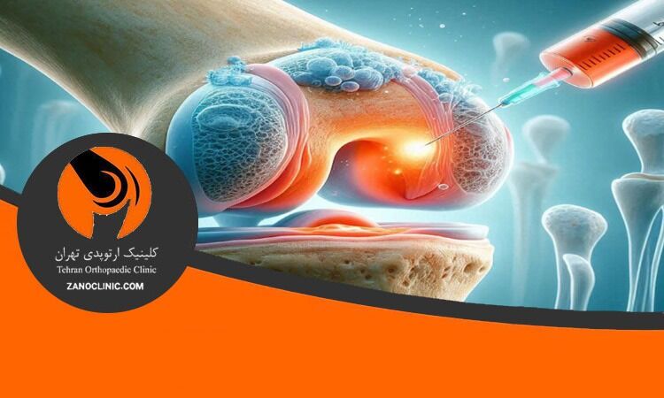 جدیدترین روش درمان زانو درد