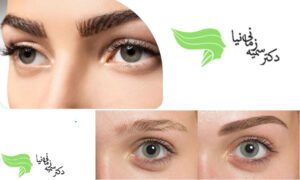 نکات کلیدی درباره انتخاب پزشک متخصص برای کاشت ابرو نکات کلیدی درباره انتخاب پزشک متخصص برای کاشت ابرو