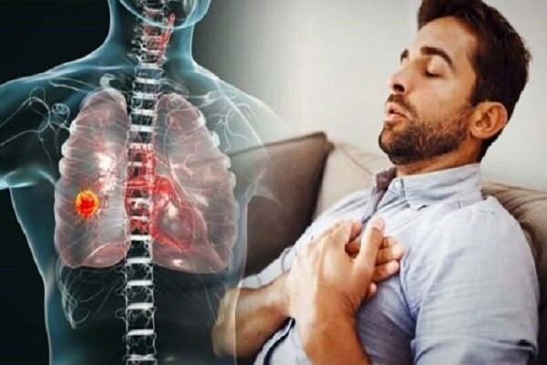راهنمای حیاتی نجات؛ چگونه در شرایط بحرانی حمله آسم را مهار کنیم؟